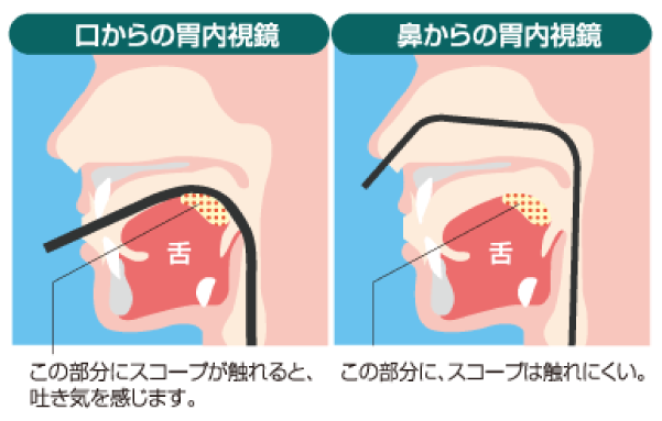 舌の奥に触りにくいので「おえっ」としにくい