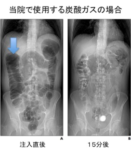 組織採取以外の処置が困難